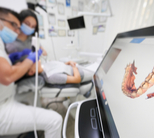 סריקה אינטרה אוראלית-תמונה